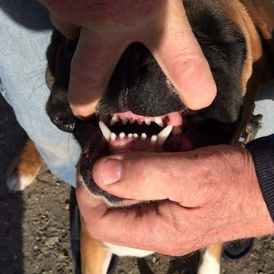 casso-teeth